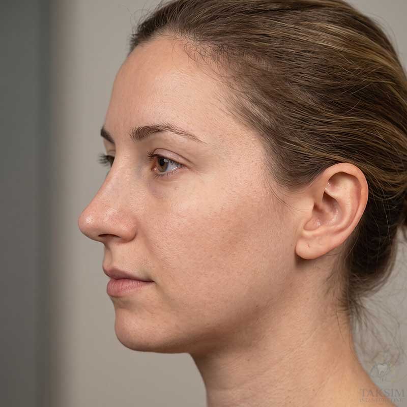 Plastic Surgery Clinic Turkey